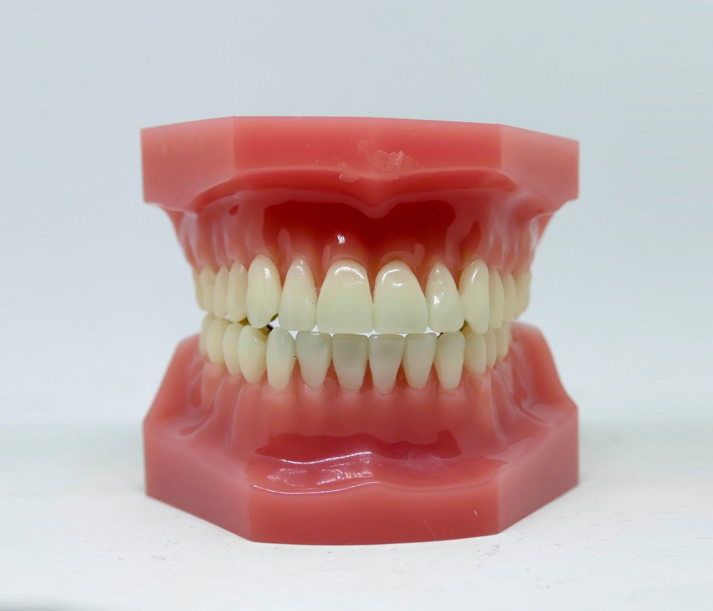 Dental model used during a comprehensive consultation